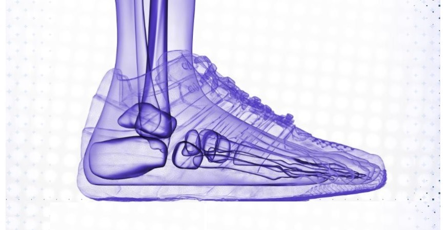 The Ultimate Guide to Choosing Sneakers Based on Foot Anatomy: Flat Feet, Bowlegs, and Beyond